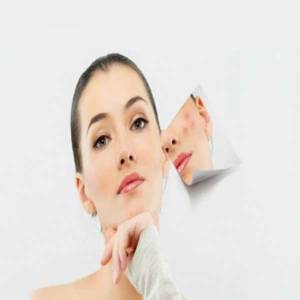 Anti Acne Treatment in Connaught Place