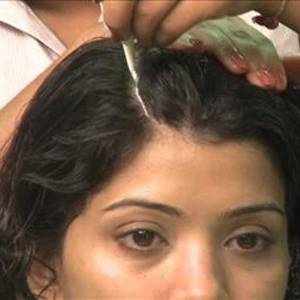 Anti Dandruff Treatment in Punjabi Bagh