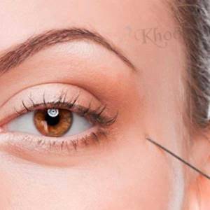 Eye Rejuvenation in Daryaganj