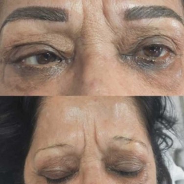 Permanent Eyebrow Enhancement in Rohini