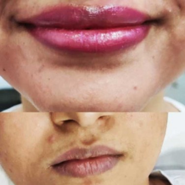 Permanent Lip Coloring in Model Town