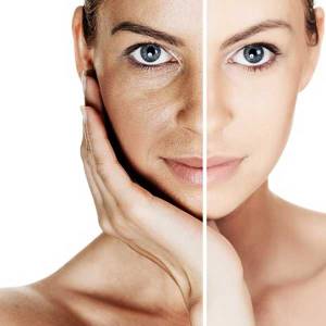 Pigmentation Treatment in Saket