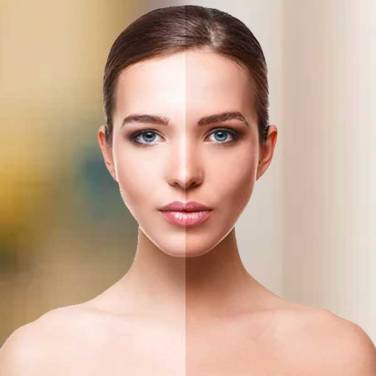 Tan Removal in Lajpat Nagar