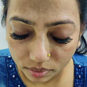  Eye Enhancement in Pritam Vihar