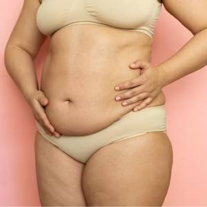 Abdominal Sagging in Delhi