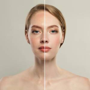 Anti Aging Treatment in Paschim Vihar