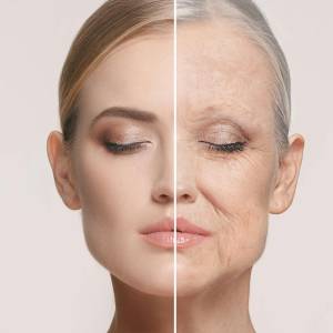 Anti Aging Treatment in Delhi