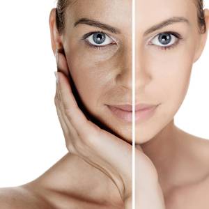 Anti Aging Treatment in Delhi