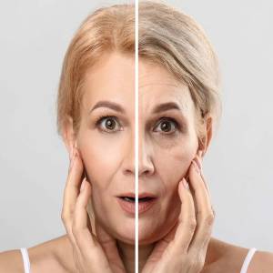 Anti Aging Treatment in Paschim Vihar