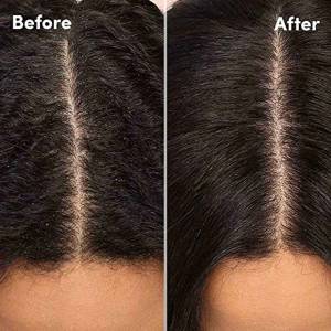 Anti Dandruff Treatment in Vivek Vihar