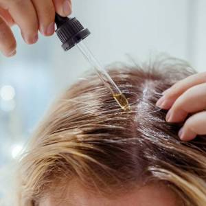 Anti Dandruff Treatment in Vasant Vihar