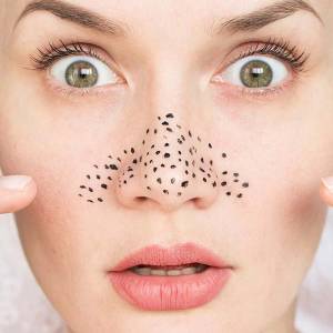 Blackhead Removal in Pritam Vihar