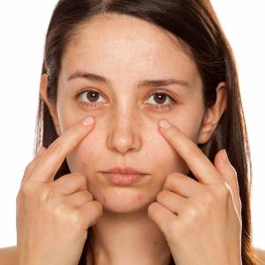 Dark Circles Treatment in Okhla