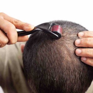 Derma Rollers for Hair Growth and Stop Hair Fall in Connaught Place