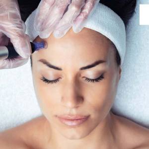 Derma Rollers for Skin Tightening and Enhancement in Karawal Nagar