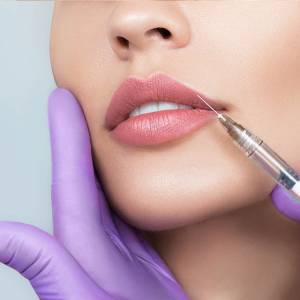 Filler for lip enhancement in Chanakyapuri