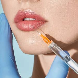 Filler for lip enhancement in Model Town