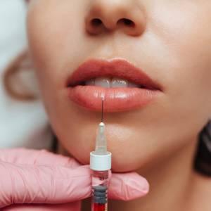 Filler for lip enhancement in Model Town