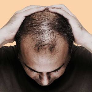 Hair Fall Treatment in Ashok Nagar