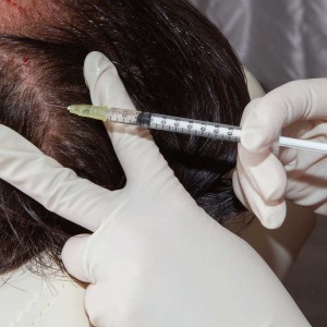 Hair Growth Treatment in Janakpuri