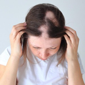 Hair Growth Treatment in Agra