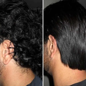 Hair Treatment in Civil Lines