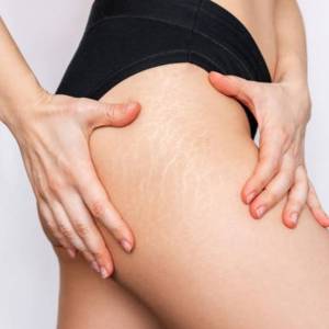 Hip Tuck in Karawal Nagar