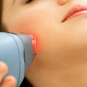 Laser Skin Treatment in Noida