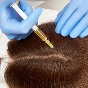 Mesotherapy for Hair Growth and Stop Hair Fall in Chandni Chowk