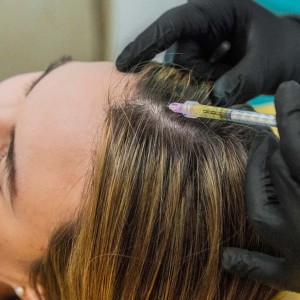 Mesotherapy for Hair Growth and Stop Hair Fall in Chandni Chowk