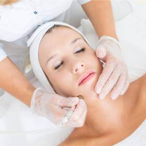 Microdermabrasion Treatment for Skin Resurfacing in Kalkaji