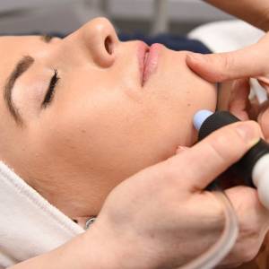 Microdermabrasion Treatment for Skin Resurfacing in Agra