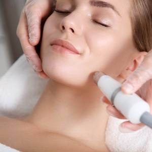 Microdermabrasion Treatment for Skin Resurfacing in Preet Vihar