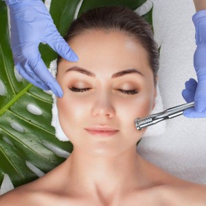 Microdermabrasion Treatment for Skin Resurfacing in Defence Colony