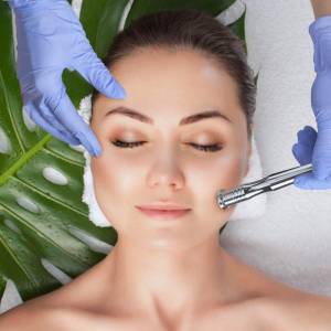 Microdermabrasion Treatment for Skin Resurfacing in Nehru Place