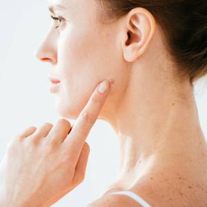 Mole Treatment in Delhi