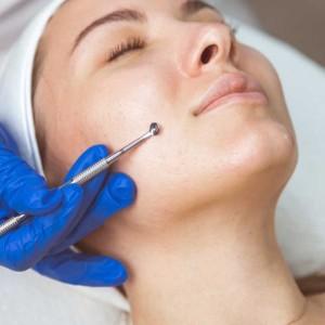 Open Pores Treatment in Vasant Kunj