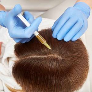 PRP Treatments for Hair Growth and Stop Hair Fall in Vasant Kunj