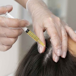 PRP Treatments for Hair Growth and Stop Hair Fall in Rajasthan