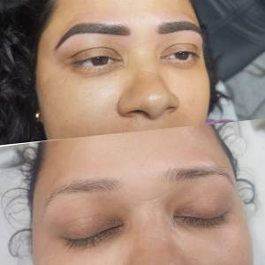 Permanent Eyebrow Enhancement in Agra