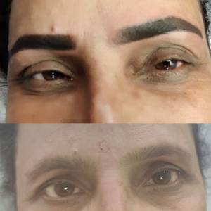Permanent Eyebrow Enhancement in Agra