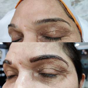 Permanent Eyebrow Enhancement in Agra
