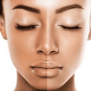 Photo Facial for Skin Lightening in India