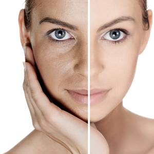 Pigmentation treatment in Agra