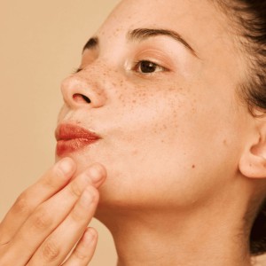 Pimple Treatment in Saket
