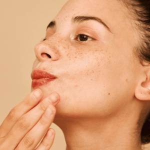 Pimple Treatment in Punjabi Bagh