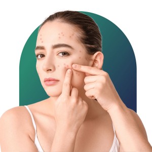 Pimple Treatment in Connaught Place