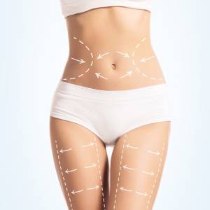 Slimming in Delhi