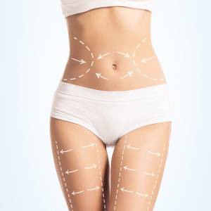 Slimming in Civil Lines