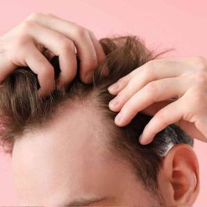 Stem Cell Therapy for Hair Growth and Stop Hair Fall in Delhi